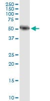 IHC-plus™ Monoclonal Mouse anti-Human AMY1A / Salivary Amylase Antibody (clone 2D4, IHC, WB)