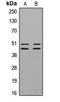 Polyclonal Rabbit anti-Human VASP Antibody (phospho-Ser157, IHC, WB)