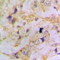 DCX / Doublecortin Antibody
