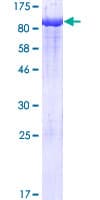 Human PCK1 Protein (Recombinant GST)