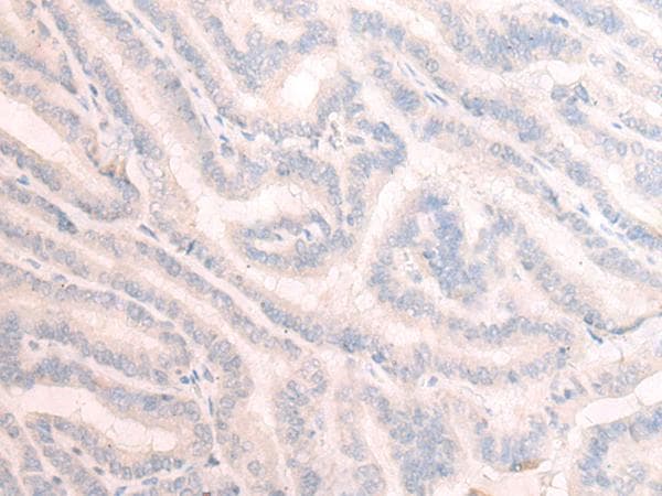Polyclonal Rabbit anti-Human TBC1D2 Antibody (IHC)