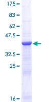 Human GALNT3 Protein (Recombinant GST)