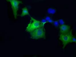 SORD / Sorbitol Dehydrogenase Antibody (clone OTI4E5, Carrier-free)