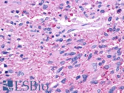 PathPlus™ CELSR2 Antibody (N-Terminus)