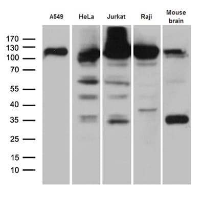 Monoclonal Mouse anti-Human IPO5 / RANBP5 Antibody (clone OTI3B8, aa1-220, WB)