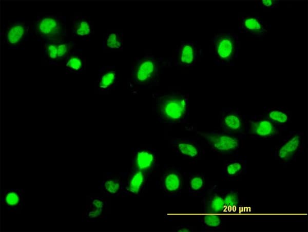 FANCG Antibody (clone 2C8)