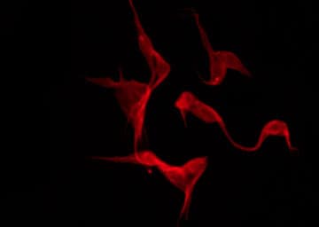 Polyclonal Rabbit anti-Human SMAD3 Antibody (phospho-Ser204, IF, WB)