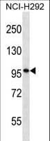 PTCHD2 Antibody (aa179-207)