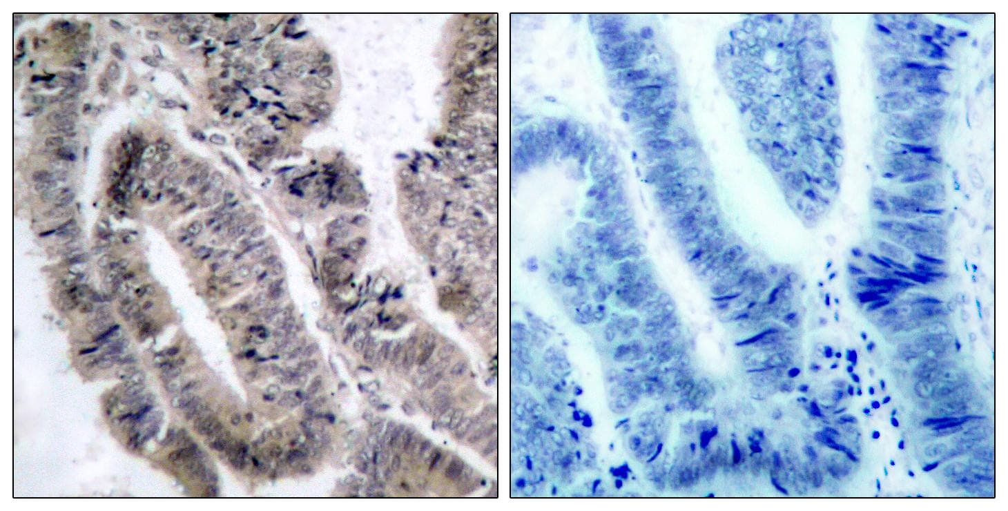PRKAA1 + PRKAA2 Antibody (phospho-Ser485/Ser491)