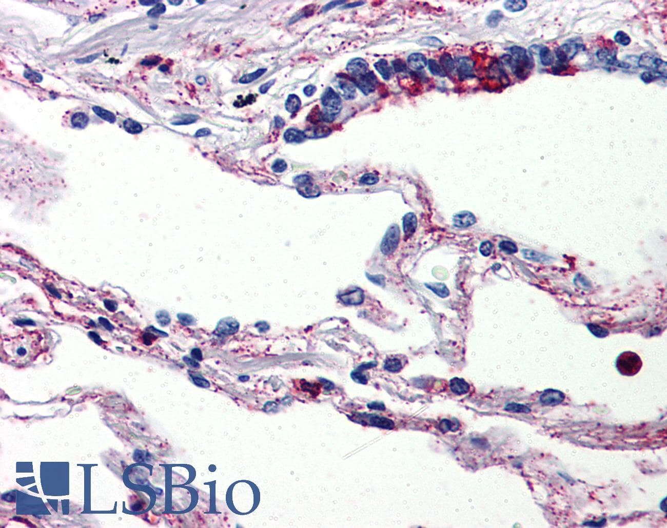 IHC-plus™ Polyclonal Rabbit anti-Human C5AR1 / CD88 / C5a Receptor Antibody (Internal, IHC)