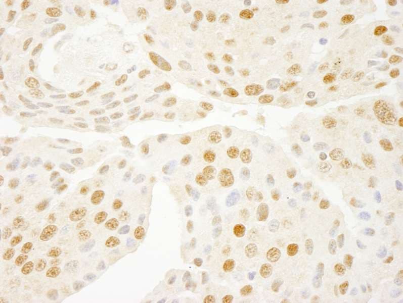 BMI1 / PCGF4 Antibody (aa276-326)