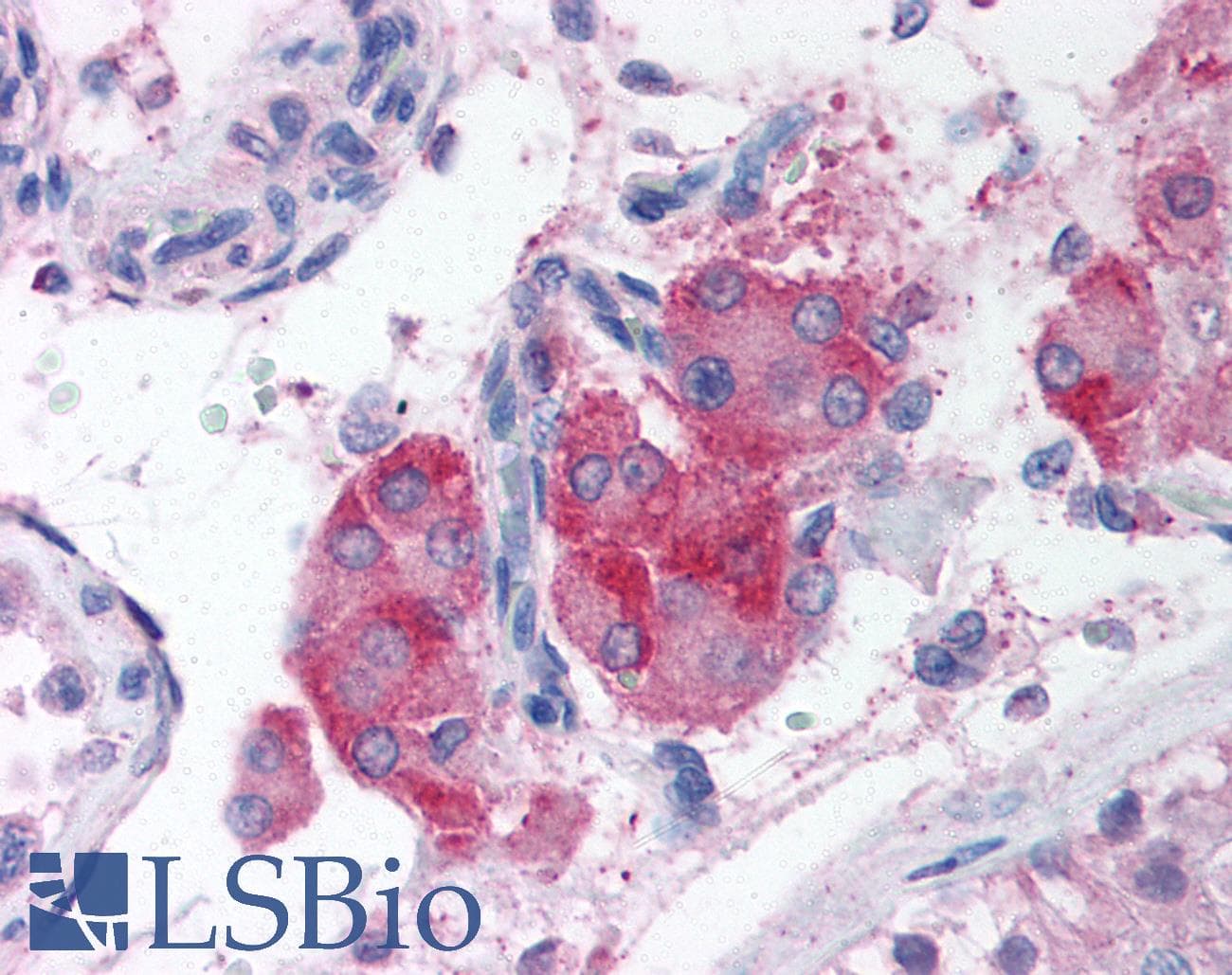 IHC-plus™ CIDEA / CIDE-A Antibody