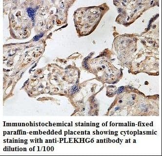 PLEKHG6 Antibody (aa196-453)