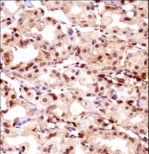 TMPO / TP / Thymopoietin Antibody (aa166-195)