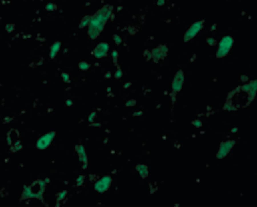 IHC-plus™ MLST8 / GBL Antibody