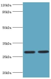 UBC6 / UBE2J2 Antibody (aa1-230)