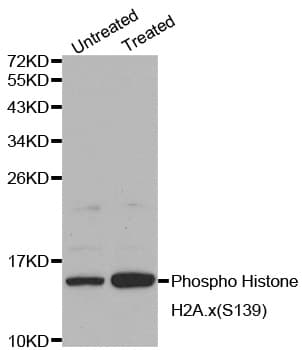 Histone H2A.X Antibody (phospho-Ser139)