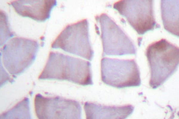 XIAP Antibody (Gly81)