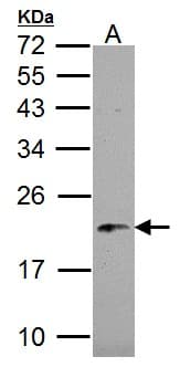 NDUFB5 Antibody (aa126-189)