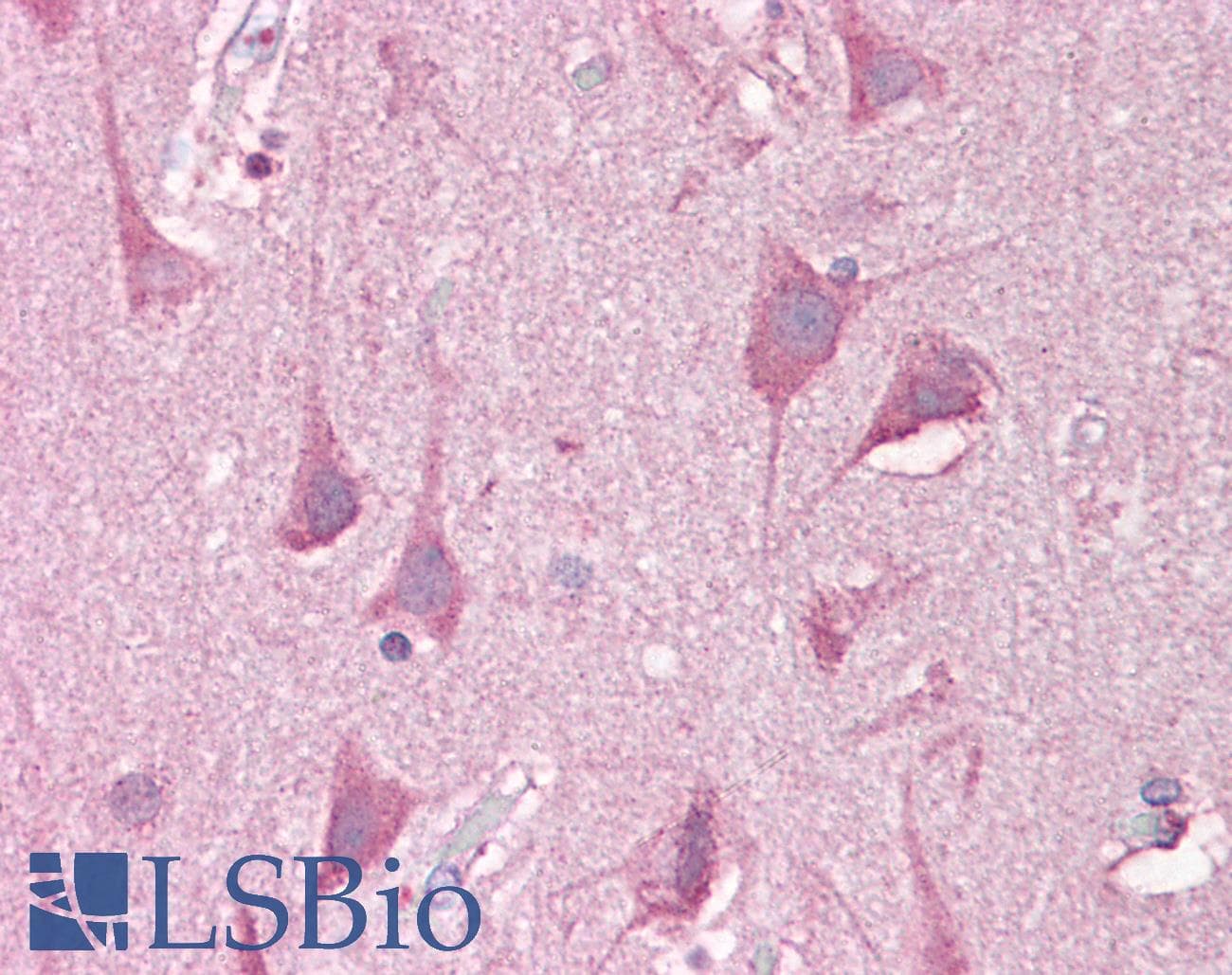 IHC-plus™ LRRTM2 Antibody