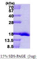 E. coli MSRB2 / MSRB Protein (Recombinant His)