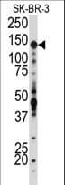 IGF1R / IGF1 Receptor Antibody (aa19-51)
