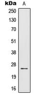 Polyclonal Rabbit anti-Human IL32 Antibody (C-Terminus, IHC, WB)