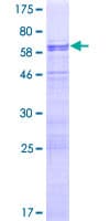 Human NUFIP1 / NUFIP Protein (Recombinant GST)