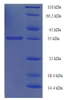 Human C12orf49 Protein (Recombinant His-SUMO)