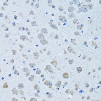 KNG1 / Kininogen / Bradykinin Antibody