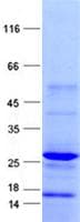 Human LBX2 Protein (Recombinant His, N-Terminal)