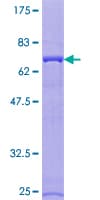 Human ATP6V1C1 Protein (Recombinant GST)