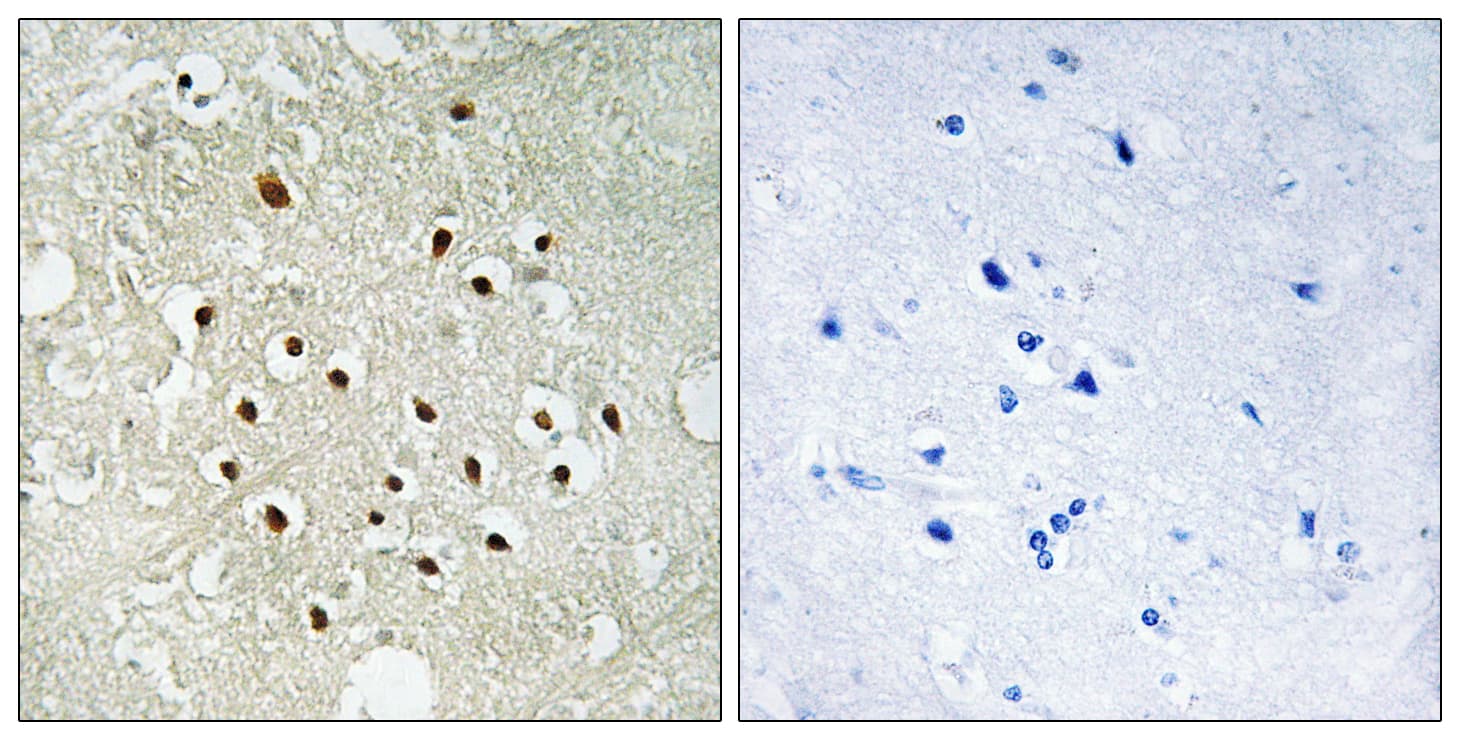 Polyclonal Rabbit anti-Human RPS19BP1 Antibody (aa71-120, IHC)