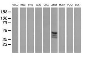 CD1C Antibody (clone OTI1F4)