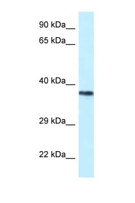 PSTPIP2 Antibody (aa122-171)