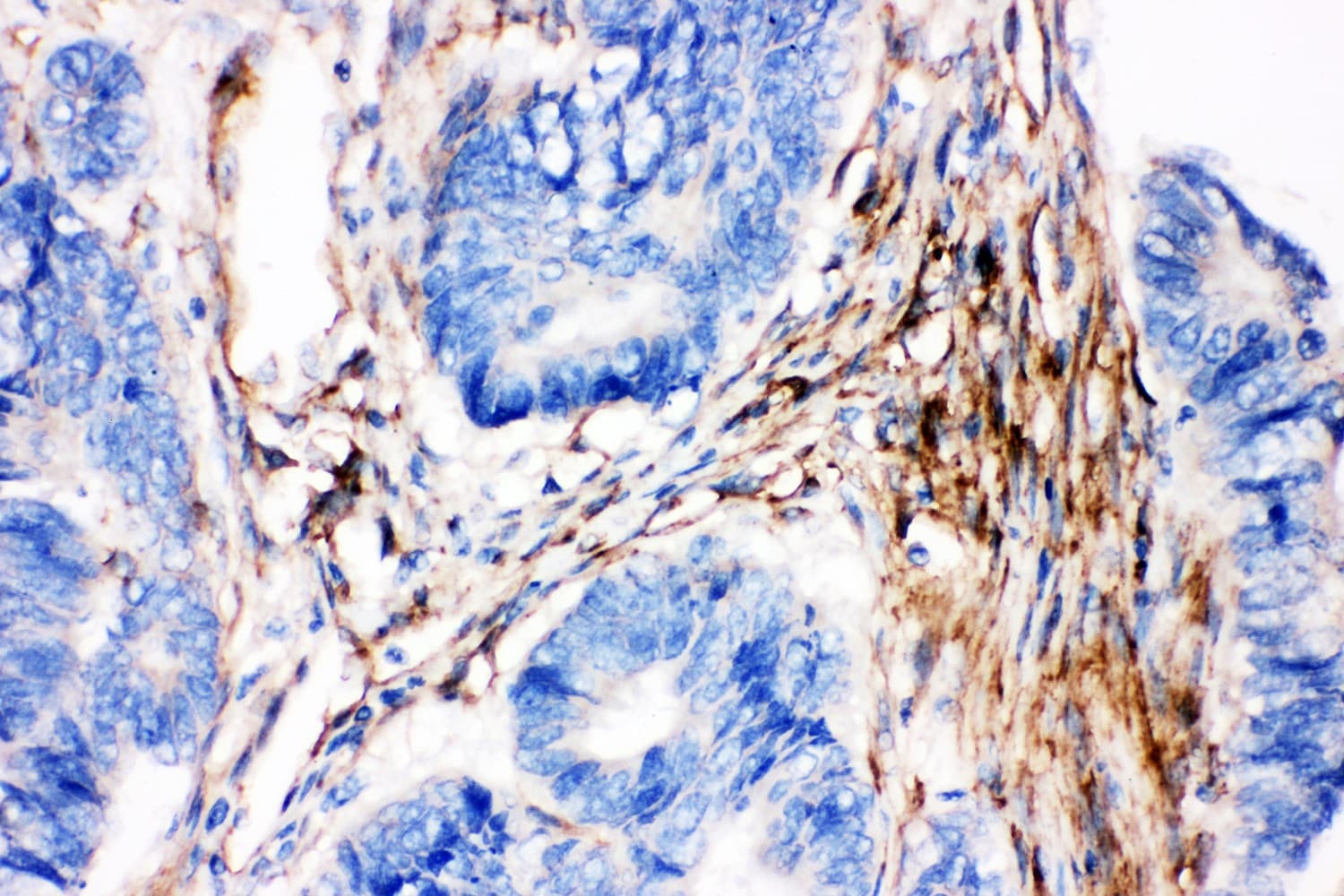 CAV2 / Caveolin 2 Antibody (aa1-162)