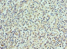 BCL11A Antibody (aa1-230)