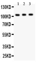 Polyclonal Rabbit anti-Human GRIK1 / GLUR5 Antibody (aa271-450, WB)