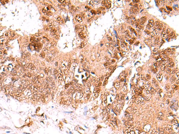 FDPS Antibody