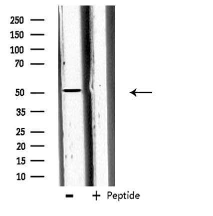 Carboxypeptidase A5 / CPA5 Antibody