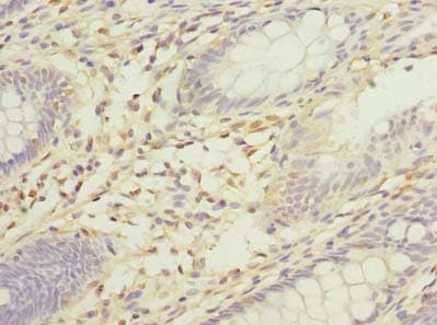 SORBS3 / Vinexin Antibody