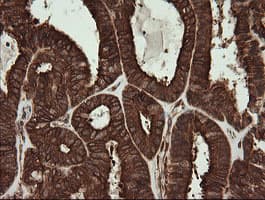POGK Antibody (clone OTI2G8)