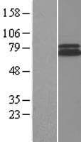 RAD1 Protein (Over-Expression Lysate Myc-DDK (Flag))