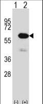 METAP2 Antibody (aa33-61)