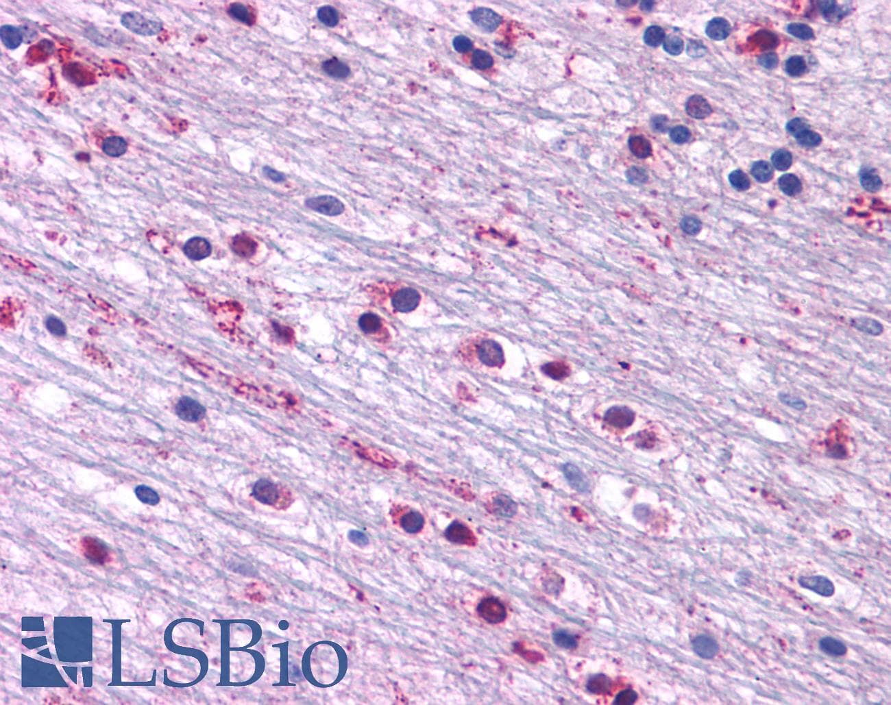 PathPlus™ CRFR1 / CRHR1 Antibody (N-Terminus)