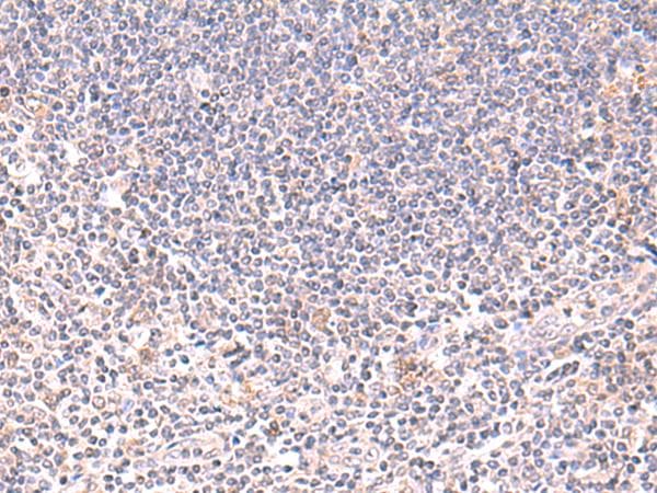 Polyclonal Rabbit anti-Human DHPS Antibody (IHC, WB)