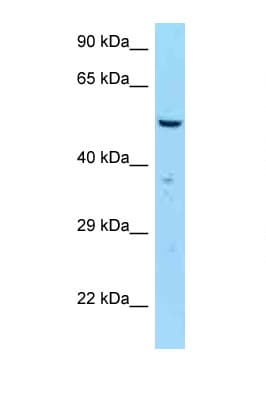 SAS6 / SASS6 Antibody (aa402-451)