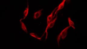 CXADR Antibody (aa16-44)