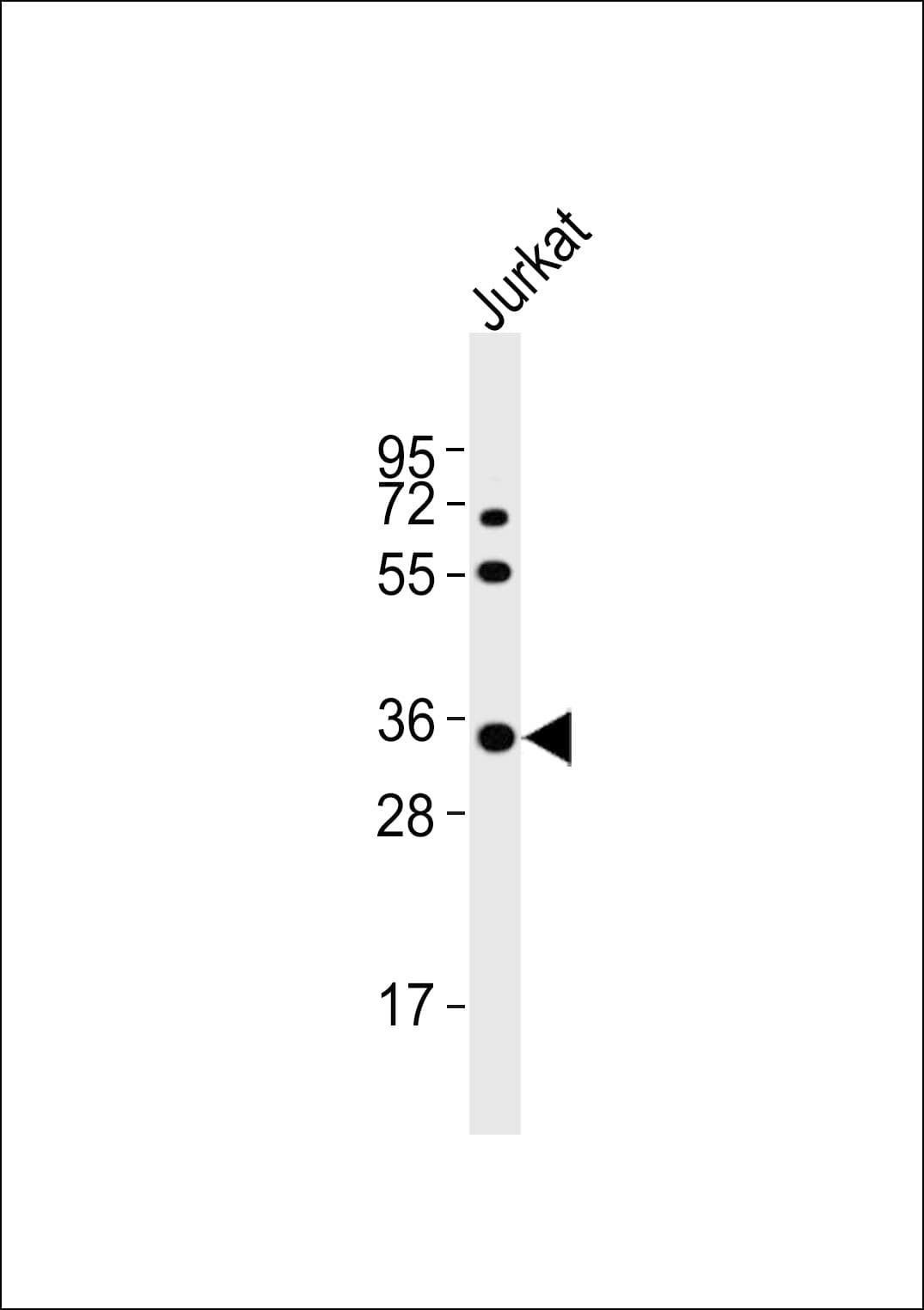 NTM / Neurotrimin Antibody