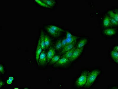 TRIM54 / MURF Antibody